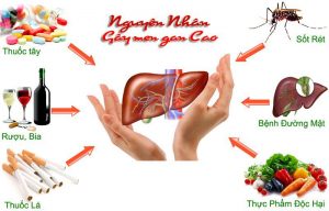 nguyên nhân bị gan nhiễm mỡ