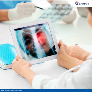 Các xét nghiệm phát hiện bệnh ung thư phổi