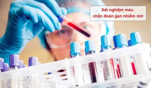 các xét nghiệm gan nhiễm mỡ