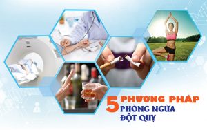 Phương pháp ngăn ngừa bệnh đột quỵ
