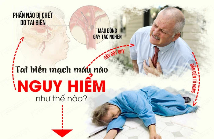 Nguyên nhân dấu hiệu và cách phòng tránh tai biến