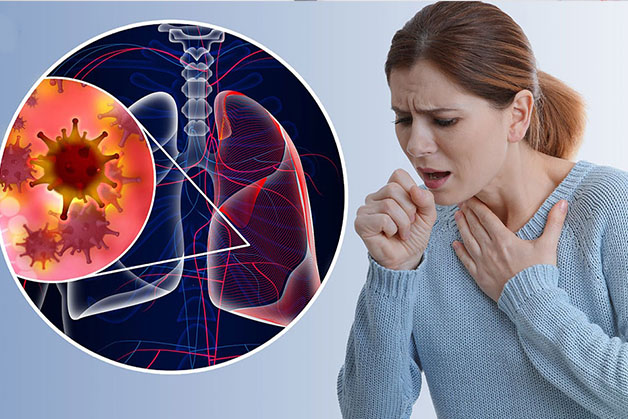 Ho kéo dài là bệnh gì?