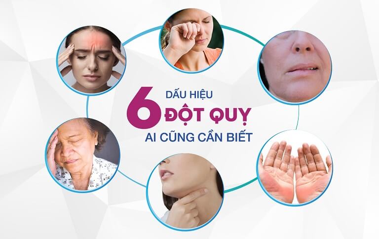 Dấu hiệu báo trước cơn đột quỵ