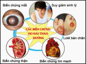 Biến chứng của bệnh đái tháo đường