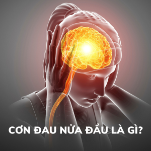 Đau nửa đầu là gì