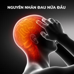 Nguyên nhân của đau nửa đầu