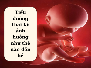 Tiểu đường thai kì ảnh hưởng đến phát triển của trẻ