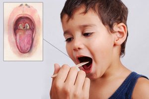 Cách phòng tránh bệnh bạch hầu