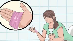 Khí hư ra nhiều ở phụ nữ thì sao
