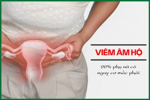 Viêm âm đạo ở phụ nữ