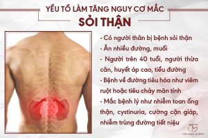 Nguyên nhân mắc sỏi thận