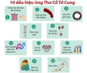 Dấu hiệu của ung thư cổ tử cung