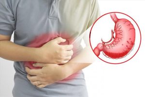 Đau dạ dày là gì?