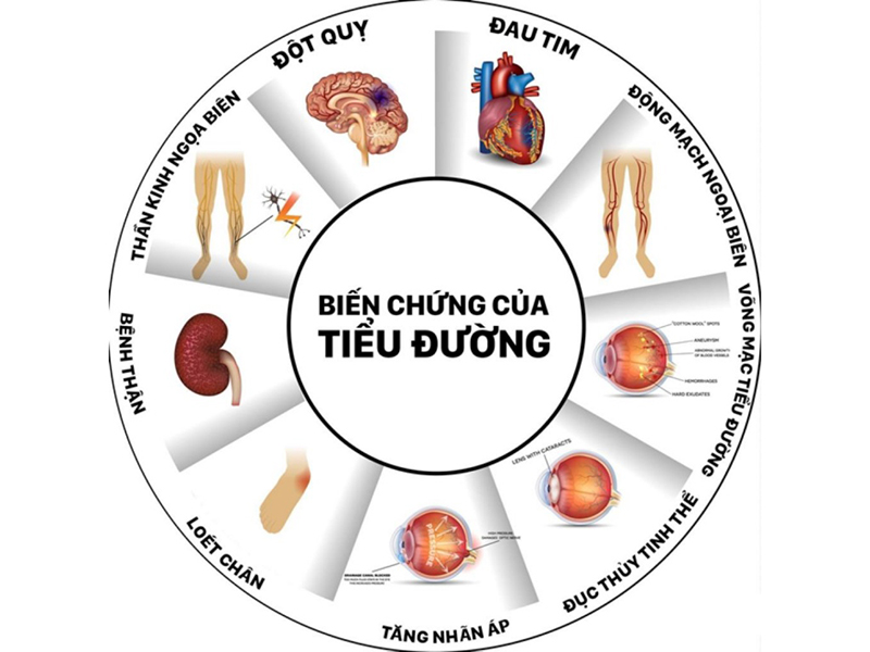 bệnh tiểu đường
